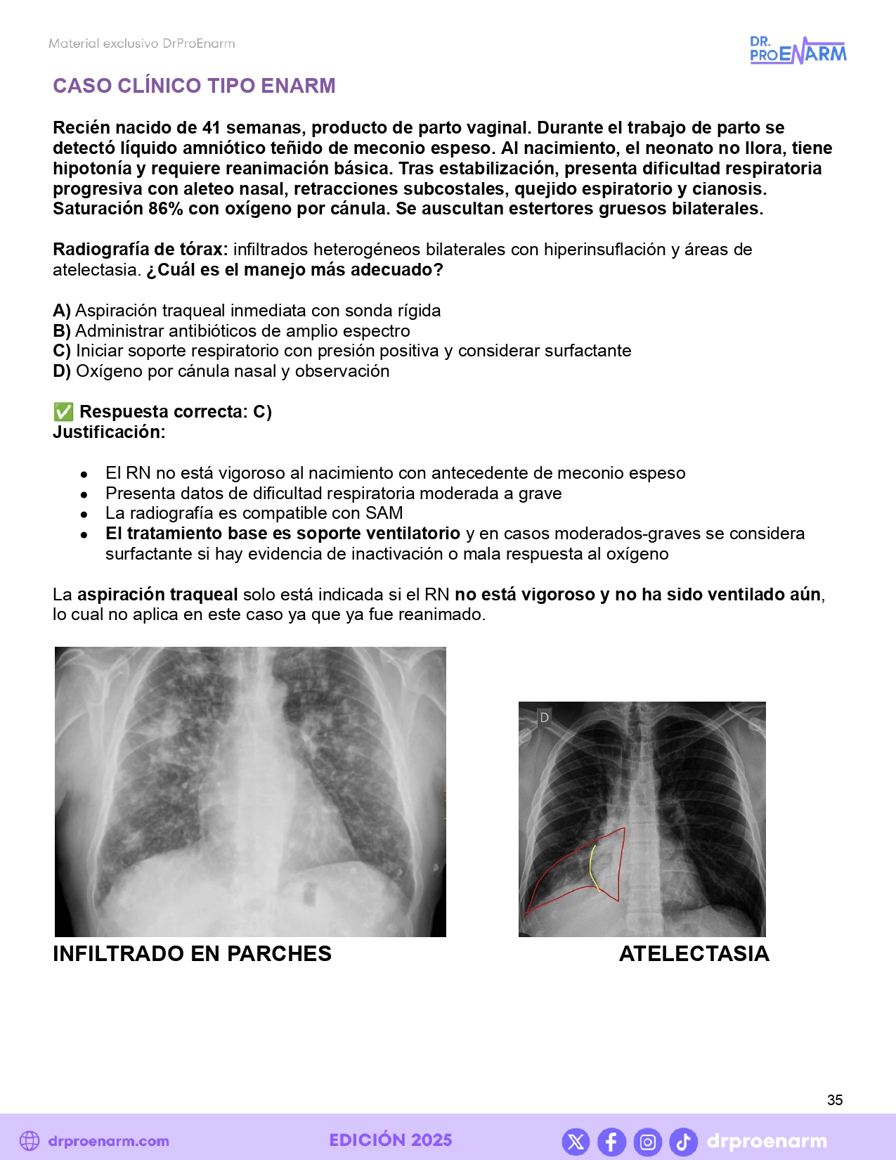 Resumen Pediatría 3